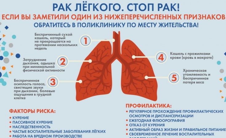Более 836 млн. рублей из средств ОМС направлено на лечение рака легкого в амбулаторных условиях